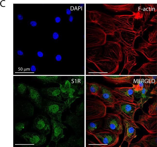 Mouse IgG (H+L) Cross-Adsorbed Secondary Antibody in Immunocytochemistry (ICC/IF)