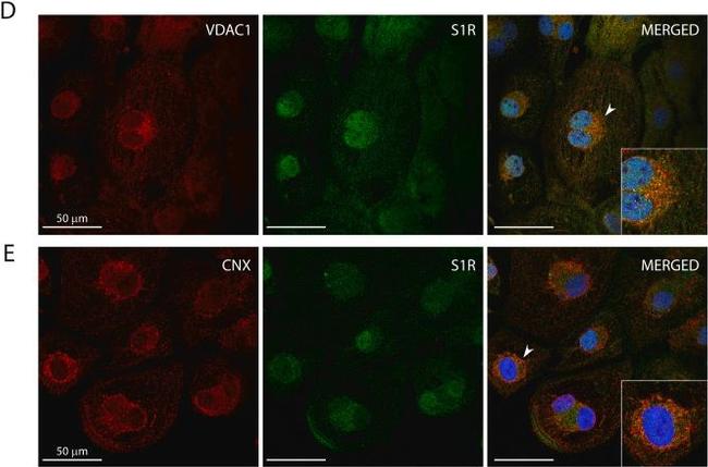 Mouse IgG (H+L) Cross-Adsorbed Secondary Antibody in Immunocytochemistry (ICC/IF)