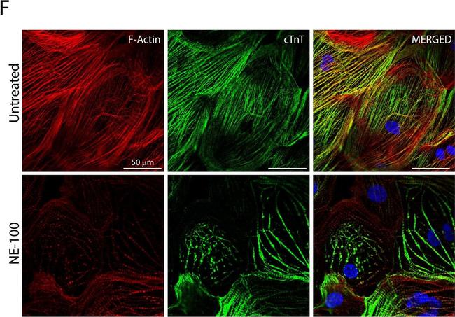 Mouse IgG (H+L) Cross-Adsorbed Secondary Antibody in Immunocytochemistry (ICC/IF)