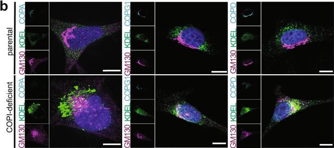 Mouse IgG (H+L) Cross-Adsorbed Secondary Antibody in Immunocytochemistry (ICC/IF)