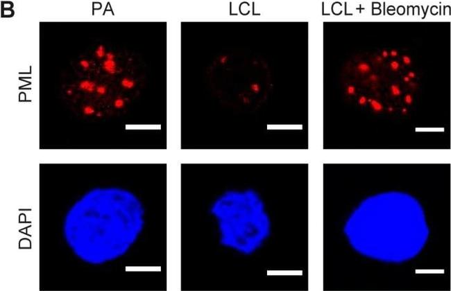 Mouse IgG (H+L) Cross-Adsorbed Secondary Antibody in Immunocytochemistry (ICC/IF)