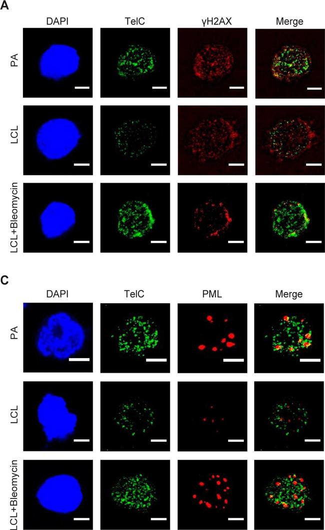 Mouse IgG (H+L) Cross-Adsorbed Secondary Antibody in Immunocytochemistry (ICC/IF)