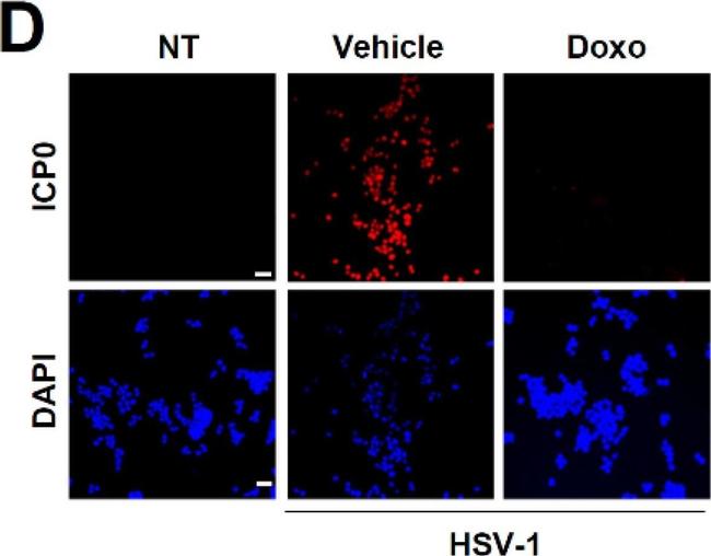 Mouse IgG (H+L) Cross-Adsorbed Secondary Antibody in Immunocytochemistry (ICC/IF)