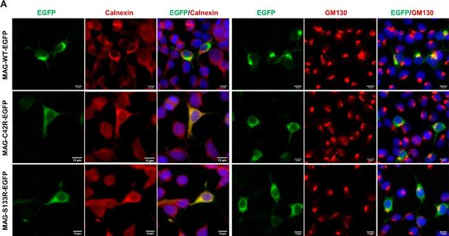 Mouse IgG (H+L) Cross-Adsorbed Secondary Antibody in Immunocytochemistry (ICC/IF)