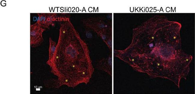 Mouse IgG (H+L) Cross-Adsorbed Secondary Antibody in Immunocytochemistry (ICC/IF)