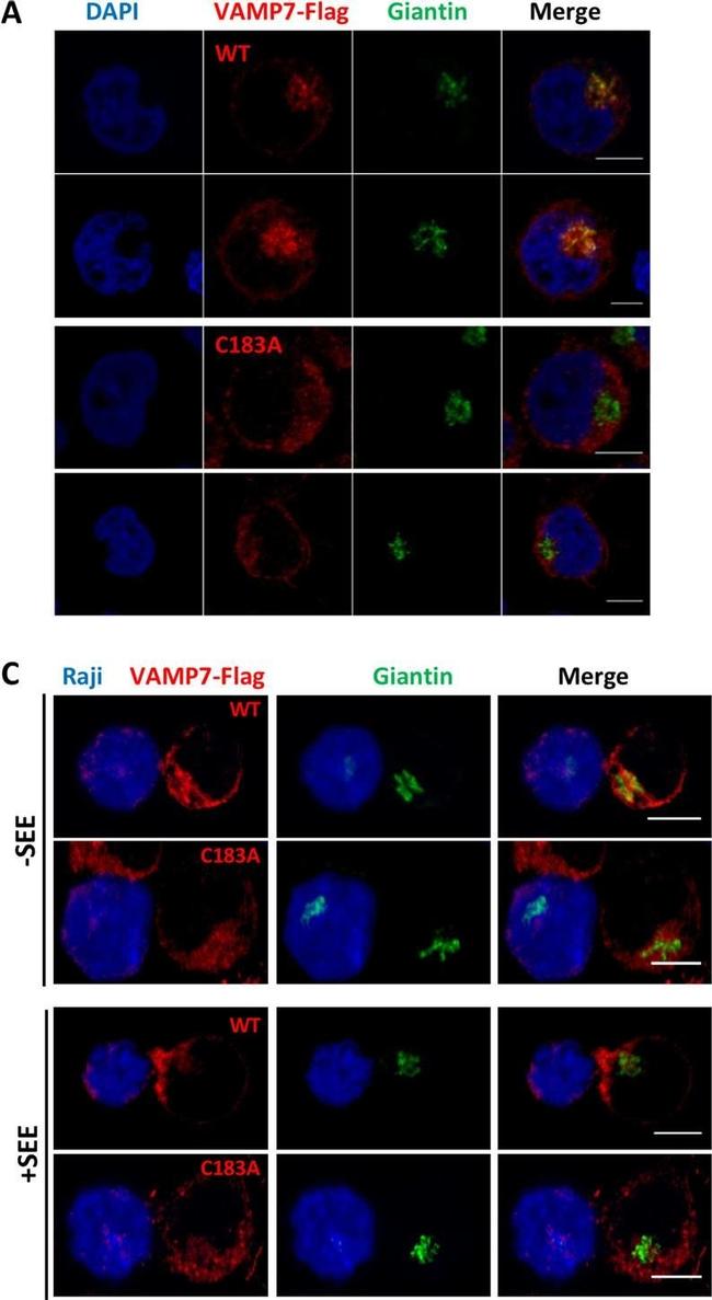 Rabbit IgG (H+L) Highly Cross-Adsorbed Secondary Antibody in Immunocytochemistry (ICC/IF)