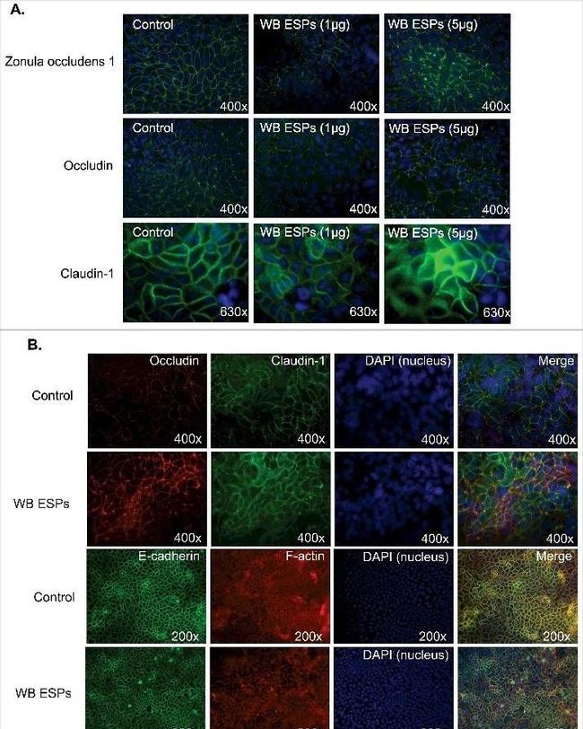 Mouse IgG (H+L) Highly Cross-Adsorbed Secondary Antibody in Immunocytochemistry (ICC/IF)