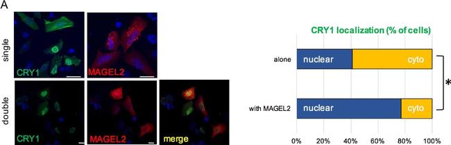 Rabbit IgG (H+L) Highly Cross-Adsorbed Secondary Antibody in Immunocytochemistry (ICC/IF)