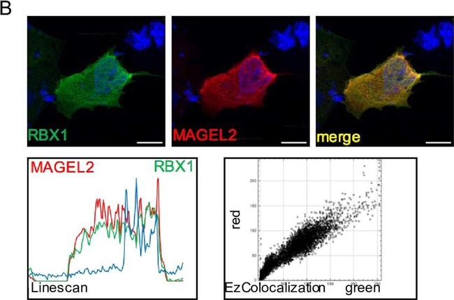 Rabbit IgG (H+L) Highly Cross-Adsorbed Secondary Antibody in Immunocytochemistry (ICC/IF)