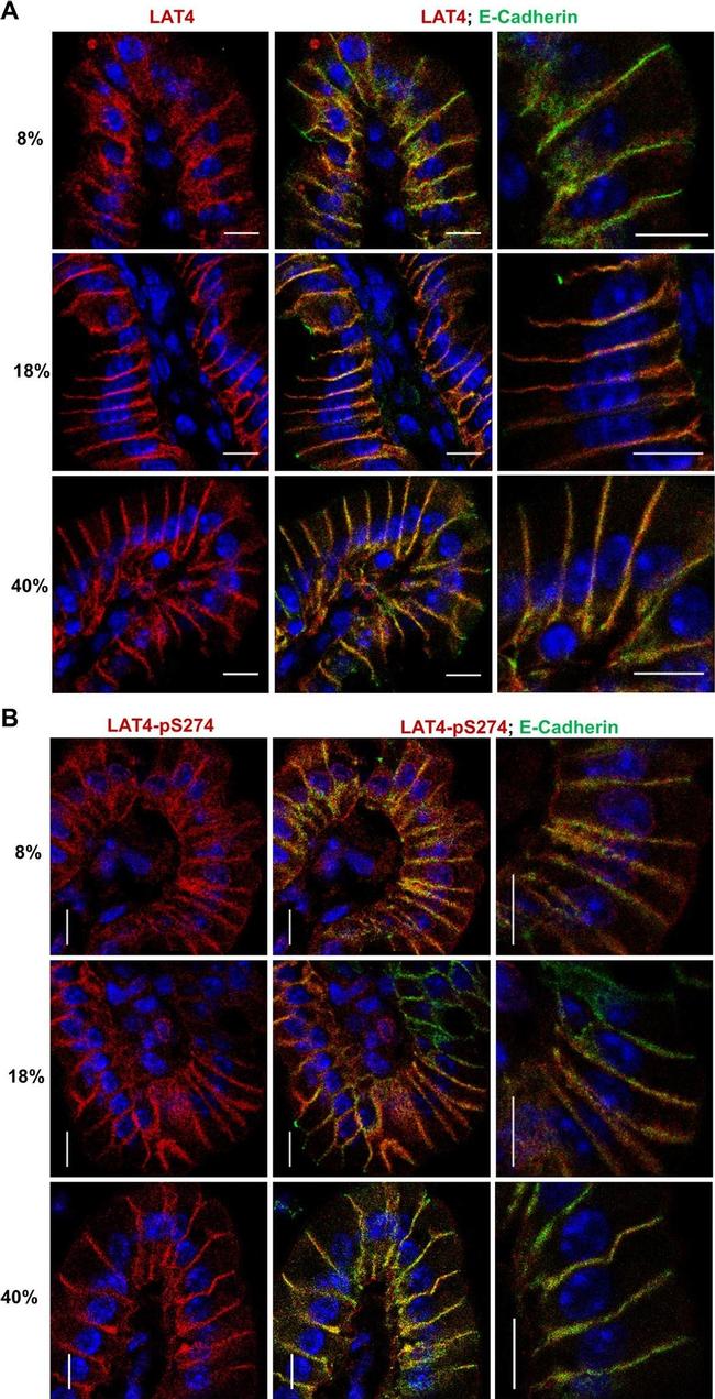 Rat IgG (H+L) Cross-Adsorbed Secondary Antibody in Immunohistochemistry (IHC)