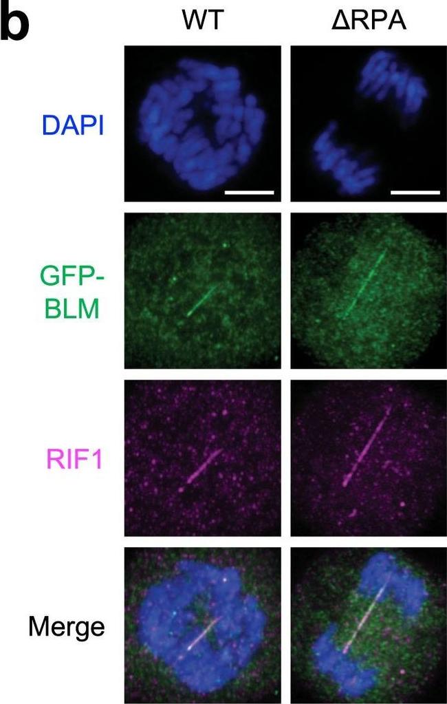 Rabbit IgG (H+L) Highly Cross-Adsorbed Secondary Antibody in Immunocytochemistry (ICC/IF)