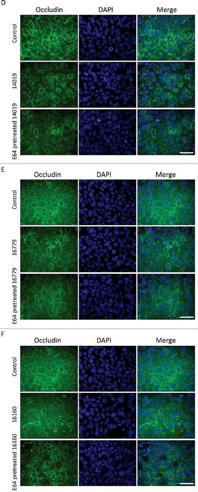 Mouse IgG (H+L) Highly Cross-Adsorbed Secondary Antibody in Immunocytochemistry (ICC/IF)