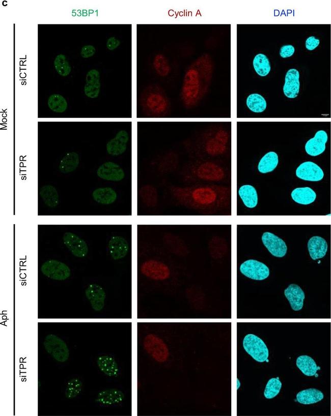 Rabbit IgG (H+L) Highly Cross-Adsorbed Secondary Antibody in Immunocytochemistry (ICC/IF)