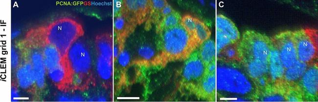 Mouse IgG (H+L) Highly Cross-Adsorbed Secondary Antibody in Immunohistochemistry (PFA fixed) (IHC (PFA))