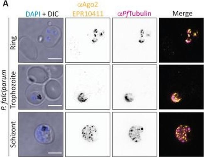 Mouse IgG (H+L) Highly Cross-Adsorbed Secondary Antibody in Immunocytochemistry (ICC/IF)