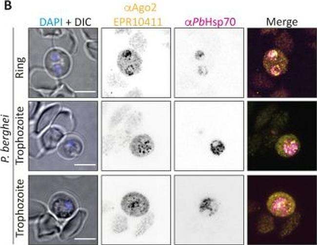 Mouse IgG (H+L) Highly Cross-Adsorbed Secondary Antibody in Immunocytochemistry (ICC/IF)