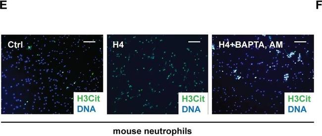 Rabbit IgG (H+L) Cross-Adsorbed Secondary Antibody in Immunocytochemistry (ICC/IF)