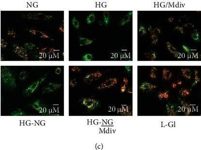 Rabbit IgG (H+L) Cross-Adsorbed Secondary Antibody in Immunocytochemistry (ICC/IF)