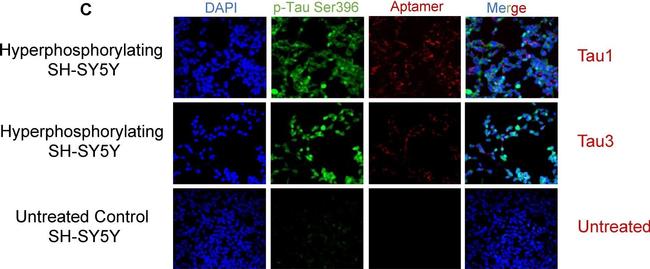 Rabbit IgG (H+L) Cross-Adsorbed Secondary Antibody in Immunocytochemistry (ICC/IF)