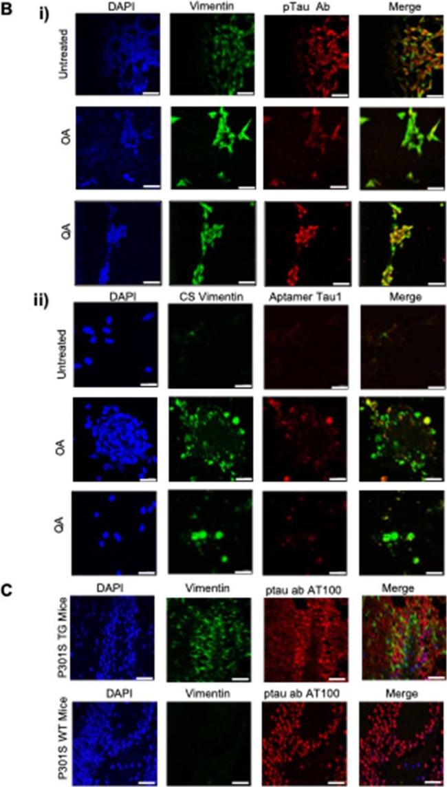 Rabbit IgG (H+L) Cross-Adsorbed Secondary Antibody in Immunocytochemistry (ICC/IF)