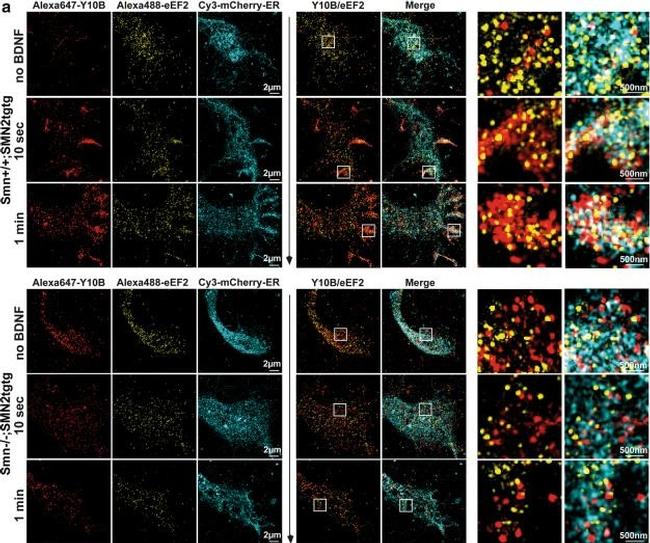 Mouse IgG (H+L) Highly Cross-Adsorbed Secondary Antibody in Immunocytochemistry (ICC/IF)