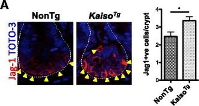 Rabbit IgG (H+L) Cross-Adsorbed Secondary Antibody in Immunohistochemistry (Paraffin) (IHC (P))