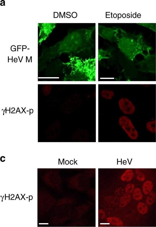 Rabbit IgG (H+L) Highly Cross-Adsorbed Secondary Antibody in Immunocytochemistry (ICC/IF)