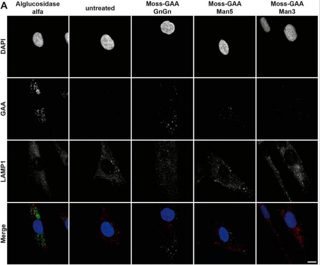 Rabbit IgG (H+L) Cross-Adsorbed Secondary Antibody in Immunocytochemistry (ICC/IF)