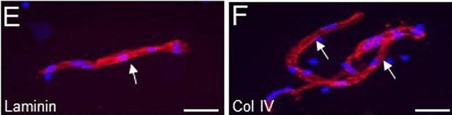 Rabbit IgG (H+L) Cross-Adsorbed Secondary Antibody in Immunohistochemistry (Paraffin) (IHC (P))