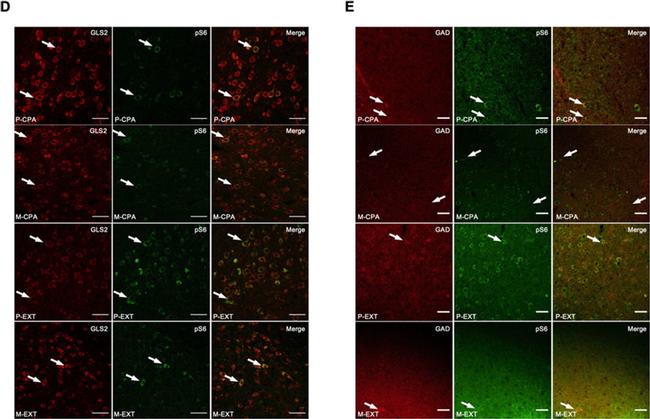 Chicken IgY (H+L) Secondary Antibody in Immunohistochemistry (IHC)