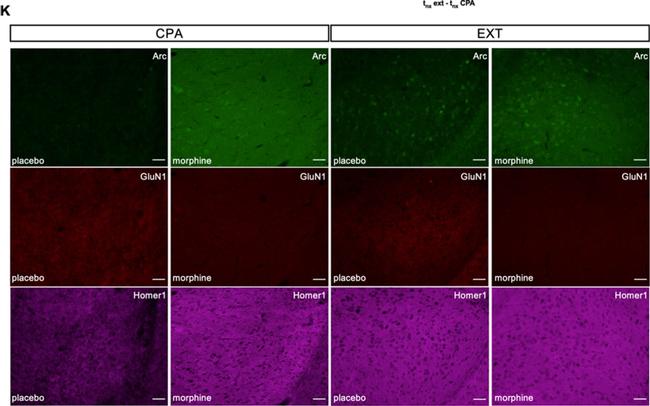 Mouse IgG (H+L) Highly Cross-Adsorbed Secondary Antibody in Immunohistochemistry (IHC)