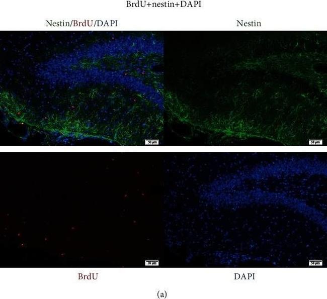 Mouse IgG (H+L) Highly Cross-Adsorbed Secondary Antibody in Immunohistochemistry (Paraffin) (IHC (P))