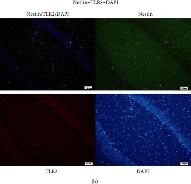 Mouse IgG (H+L) Highly Cross-Adsorbed Secondary Antibody in Immunohistochemistry (Paraffin) (IHC (P))