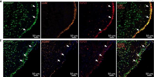 Mouse IgG (H+L) Cross-Adsorbed Secondary Antibody in Immunohistochemistry (PFA fixed) (IHC (PFA))