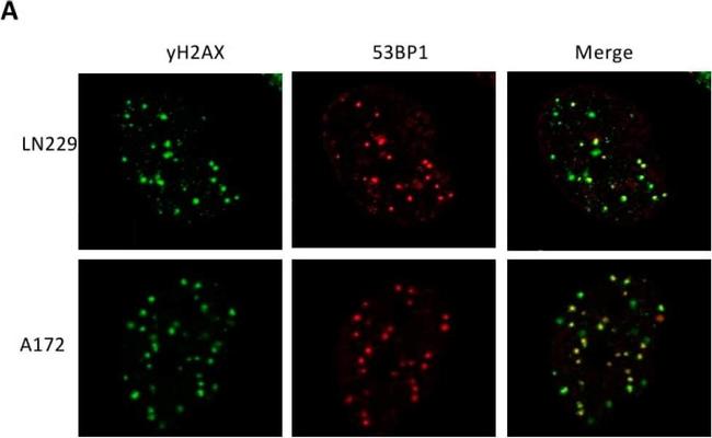 Mouse IgG (H+L) Cross-Adsorbed Secondary Antibody in Immunohistochemistry (IHC)