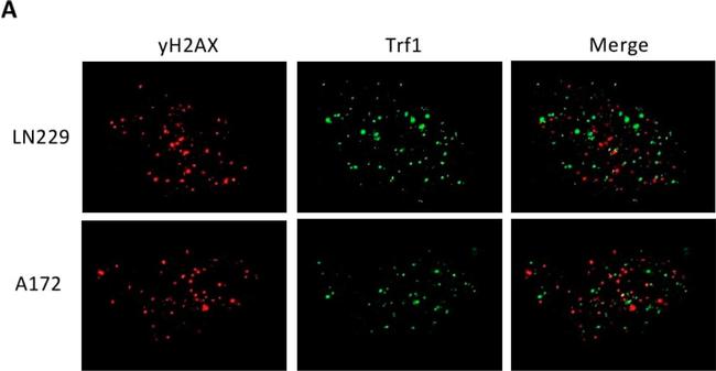 Mouse IgG (H+L) Cross-Adsorbed Secondary Antibody in Immunohistochemistry (IHC)