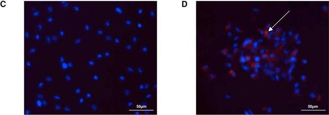 Mouse IgG (H+L) Cross-Adsorbed Secondary Antibody in Immunocytochemistry (ICC/IF)