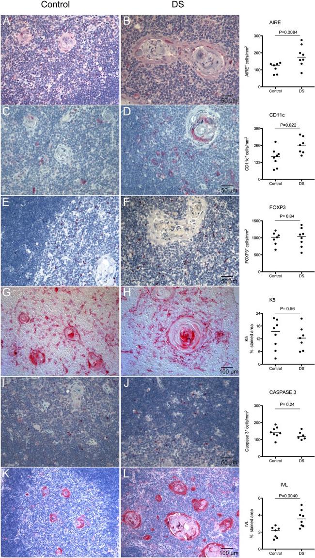 FOXP3 Antibody in Immunohistochemistry (IHC)