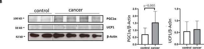 Rabbit IgG (H+L) Secondary Antibody in Western Blot (WB)