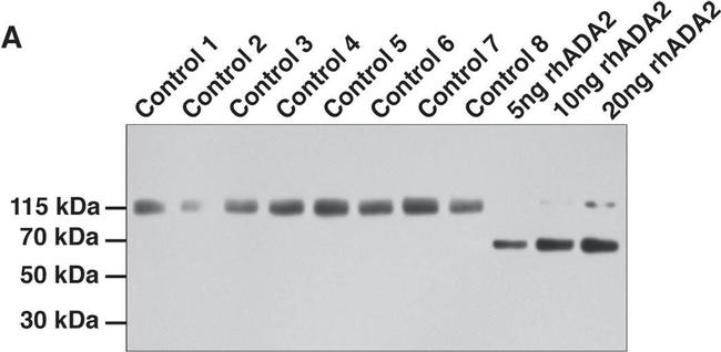 Rabbit IgG (H+L) Cross-Adsorbed Secondary Antibody in Western Blot (WB)