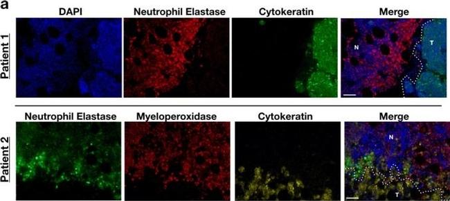 Mouse IgG (H+L) Highly Cross-Adsorbed Secondary Antibody in Immunohistochemistry (Paraffin) (IHC (P))