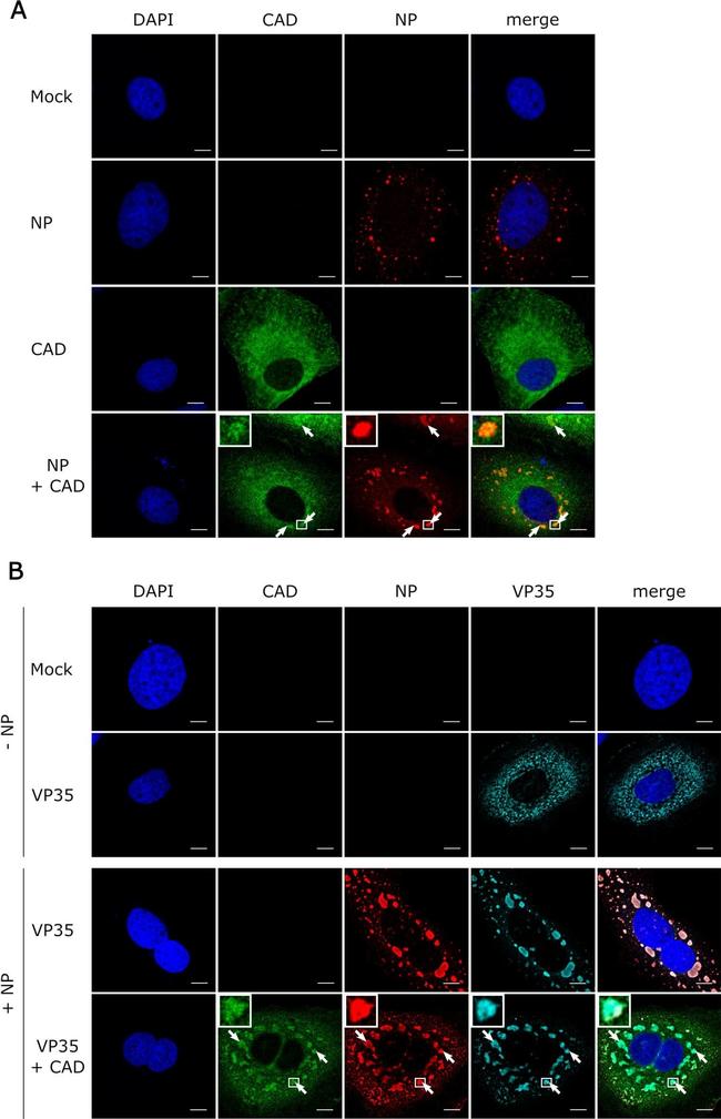 Rabbit IgG (H+L) Highly Cross-Adsorbed Secondary Antibody in Immunocytochemistry (ICC/IF)