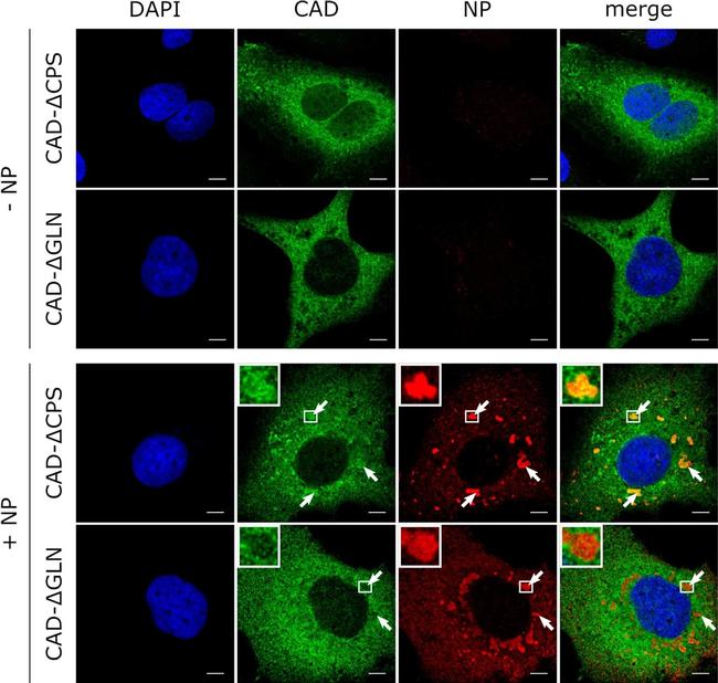 Rabbit IgG (H+L) Highly Cross-Adsorbed Secondary Antibody in Immunocytochemistry (ICC/IF)