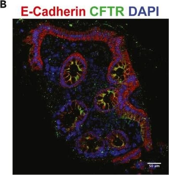 Mouse IgG (H+L) Highly Cross-Adsorbed Secondary Antibody in Immunohistochemistry (IHC)