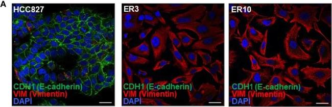 Mouse IgG (H+L) Highly Cross-Adsorbed Secondary Antibody in Immunocytochemistry (ICC/IF)