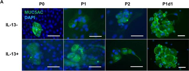 Rabbit IgG (H+L) Highly Cross-Adsorbed Secondary Antibody in Immunocytochemistry (ICC/IF)