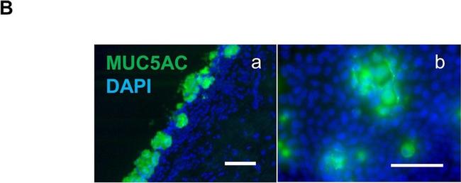 Rabbit IgG (H+L) Highly Cross-Adsorbed Secondary Antibody in Immunocytochemistry (ICC/IF)