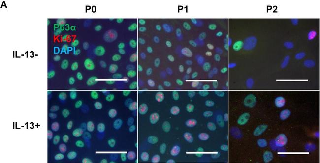 Rabbit IgG (H+L) Highly Cross-Adsorbed Secondary Antibody in Immunocytochemistry (ICC/IF)