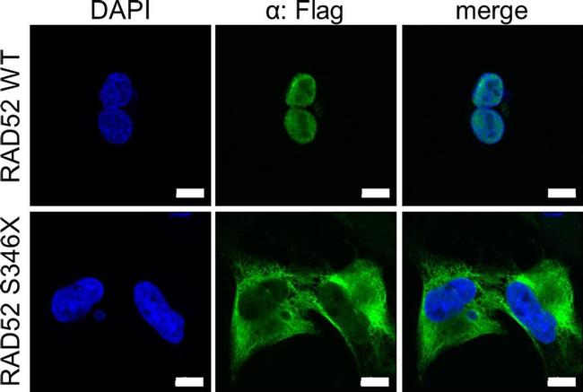 Mouse IgG (H+L) Highly Cross-Adsorbed Secondary Antibody in Immunocytochemistry (ICC/IF)