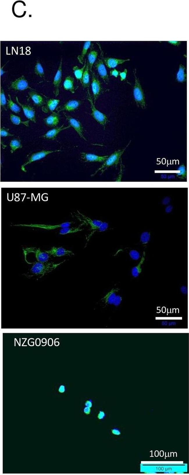 Mouse IgG (H+L) Highly Cross-Adsorbed Secondary Antibody in Immunocytochemistry (ICC/IF)